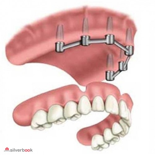 دندانسازی در کرج