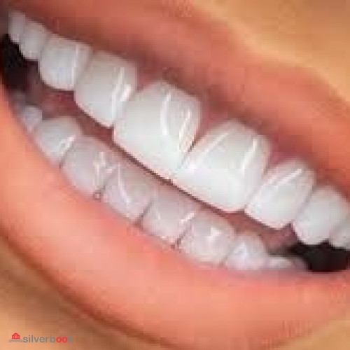 کامپوزیت و لمینیت تخصصی دندان در سعادت آباد