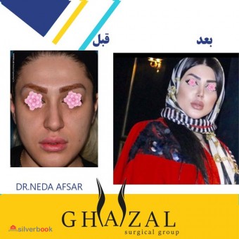 گروه جراحی زیبایی غزال