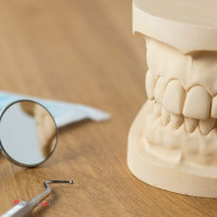 گچ آلفا دندانپزشکی