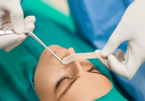 کلینیک جراحی بینی در مرزداران